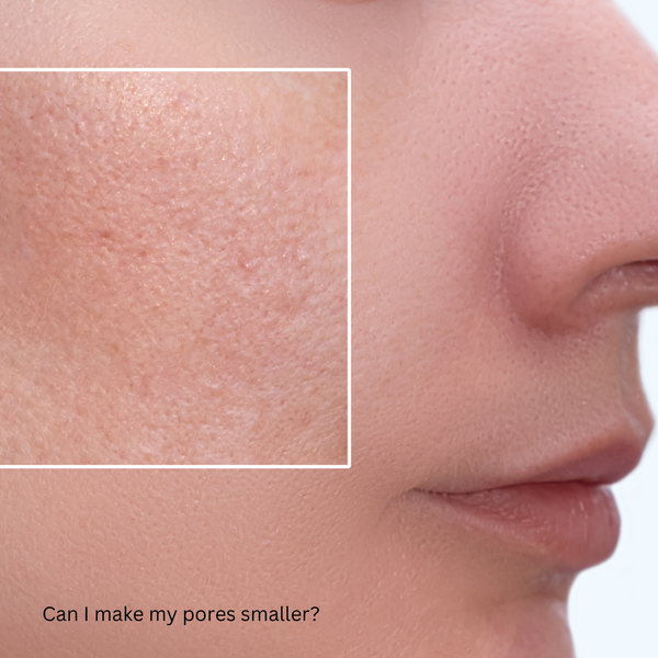 Can I make my pores smaller?