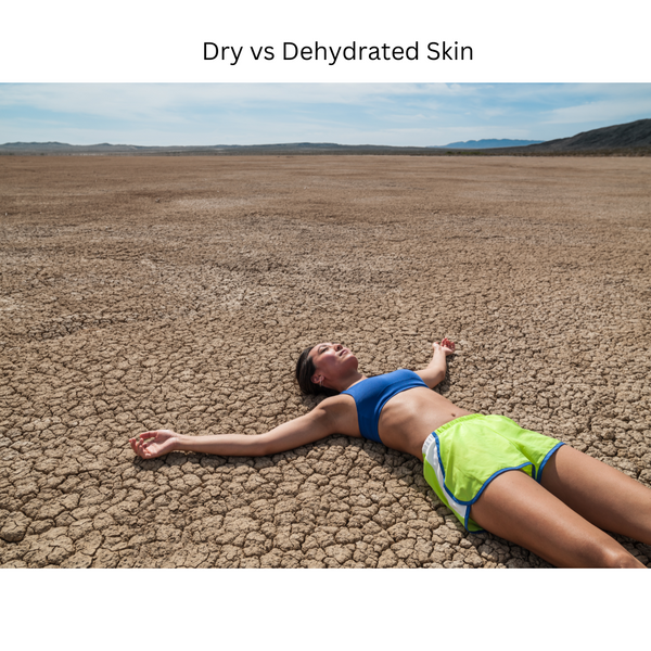 The difference between dry and dehydrated skin!